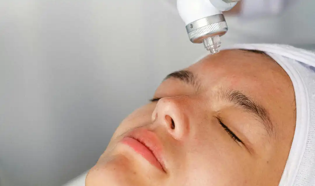 Mulher - Depilação Facial A Cera
